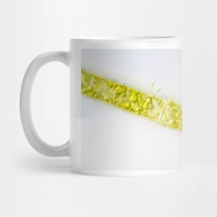 Filamentous alga under the microscope Mug